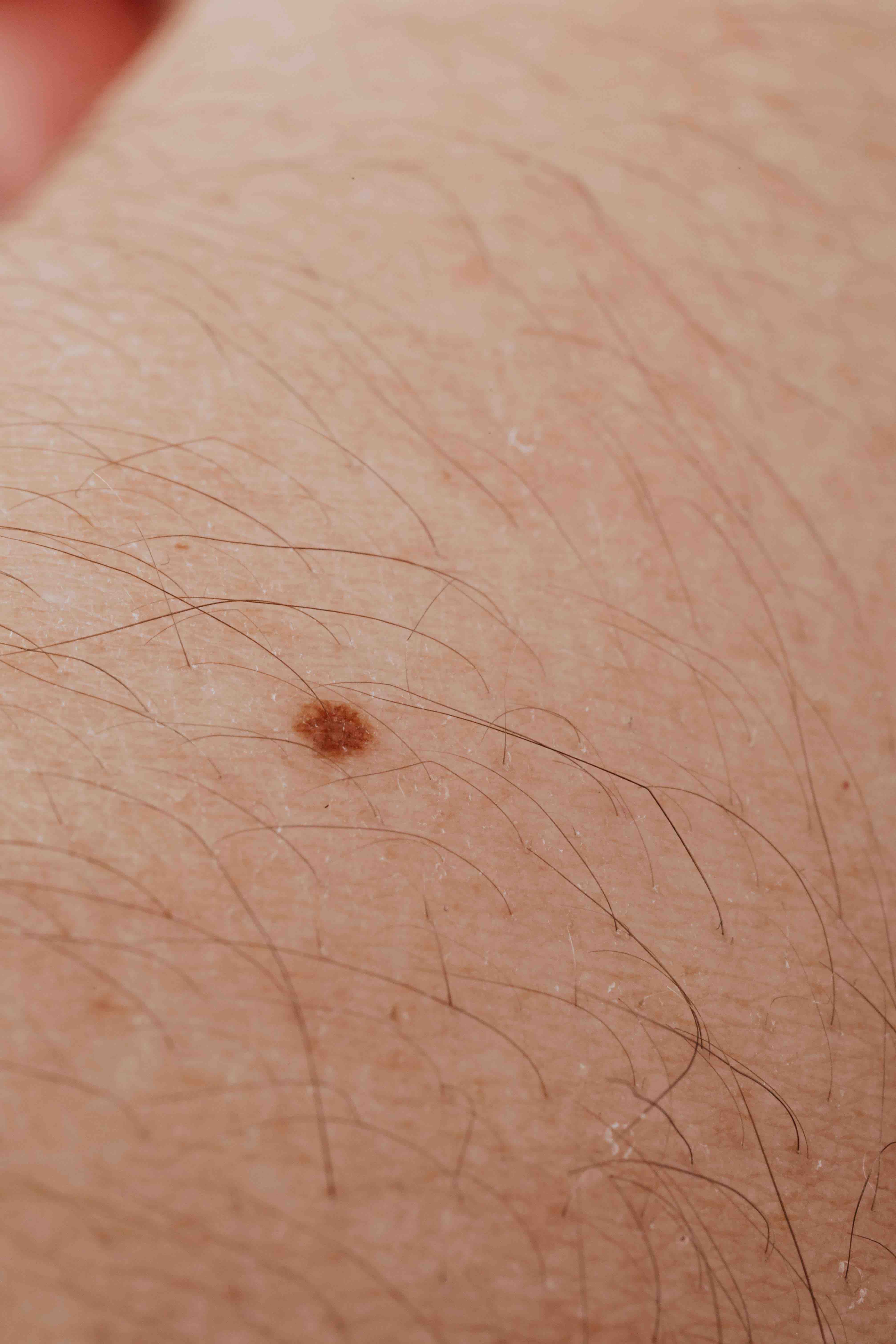 Skin image 6